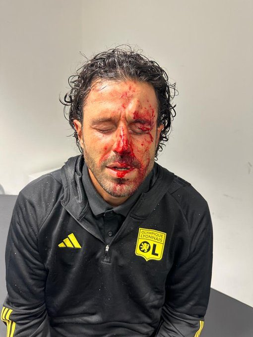 Karmea näky: Valmentajan naama kivitettiin verille