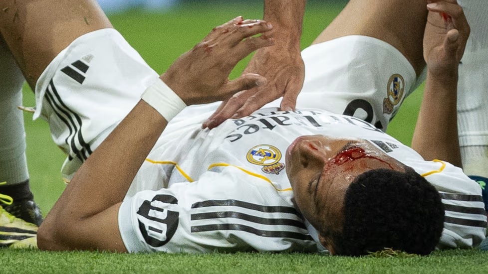 Real Madridille rankka takaisku